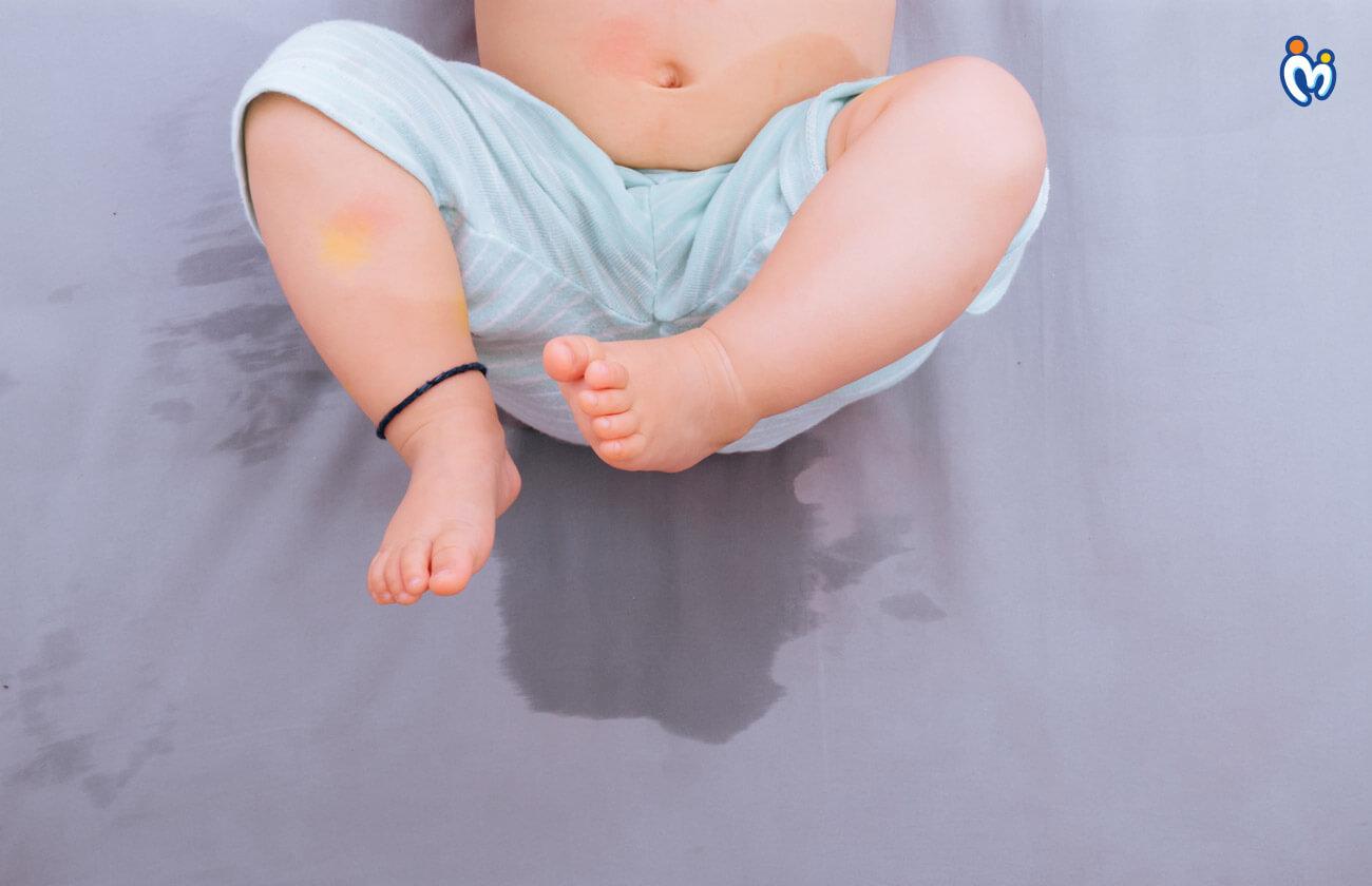 Causes of Bedwetting
