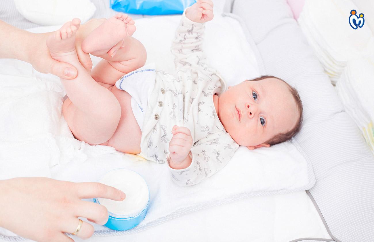 Easy remedies to treat Diaper Rashes at home