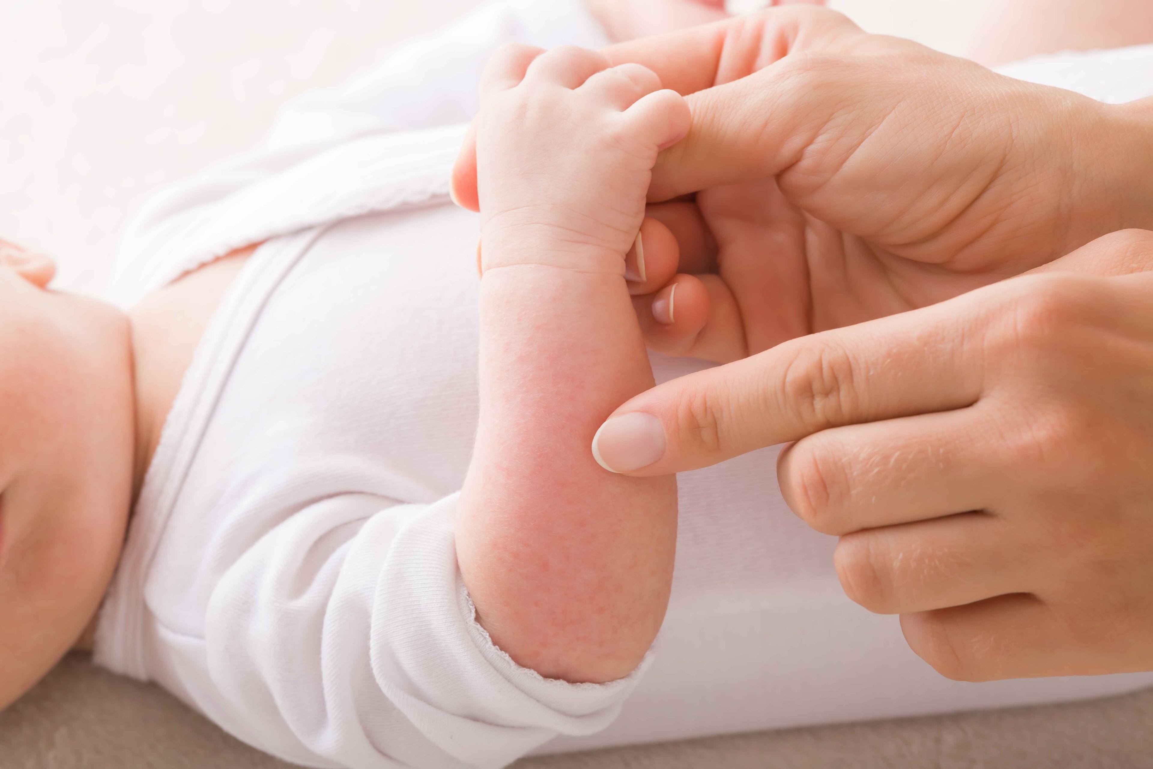 Everything a Mamy Must Know About Newborn Baby Acne