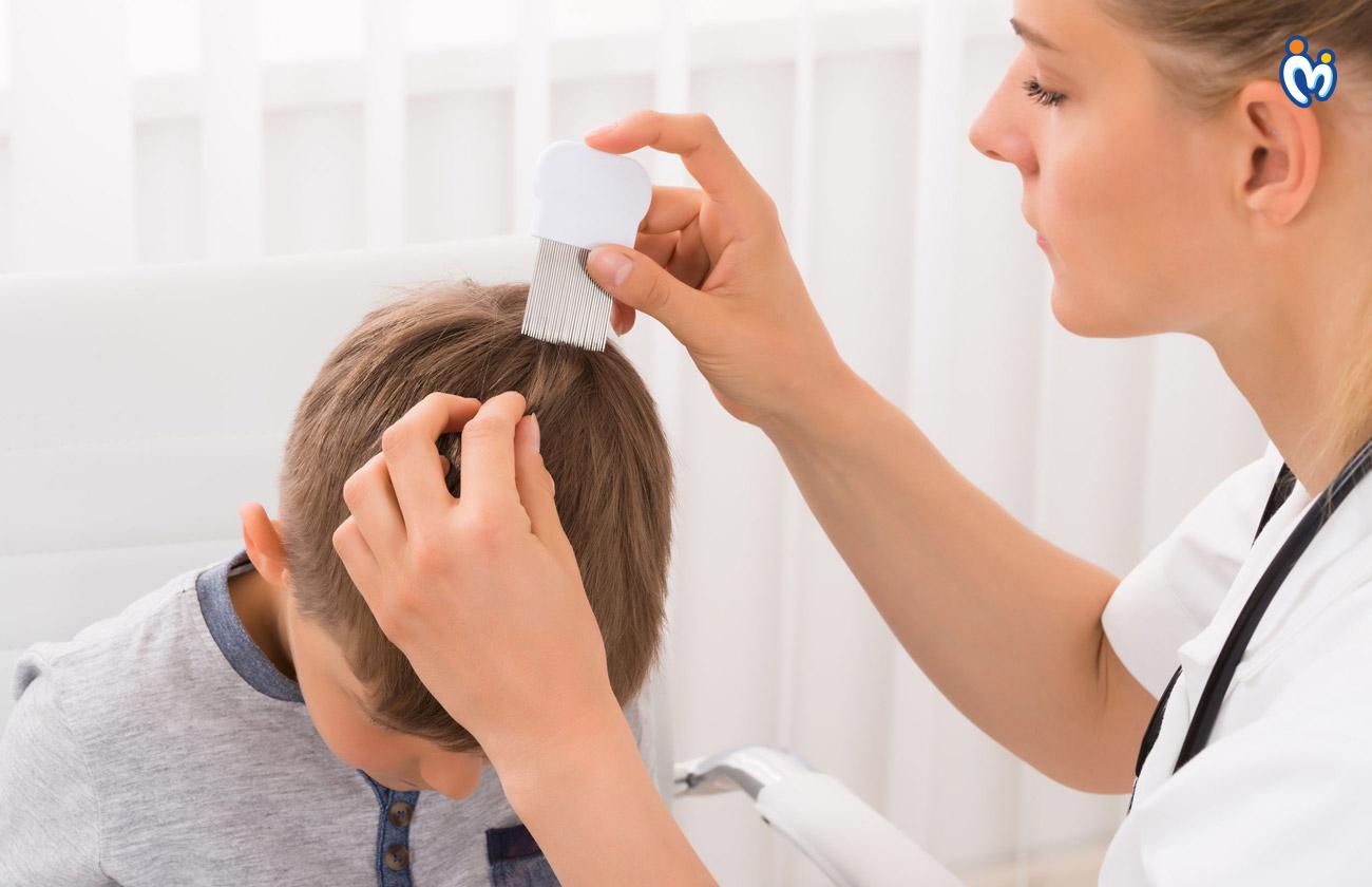 How to get rid of Head Lice in your child