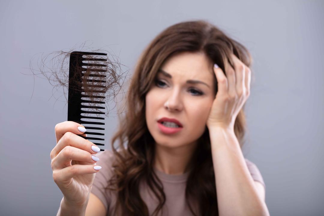 Postpartum Hair Loss: Everything A Mamy Needs to Know