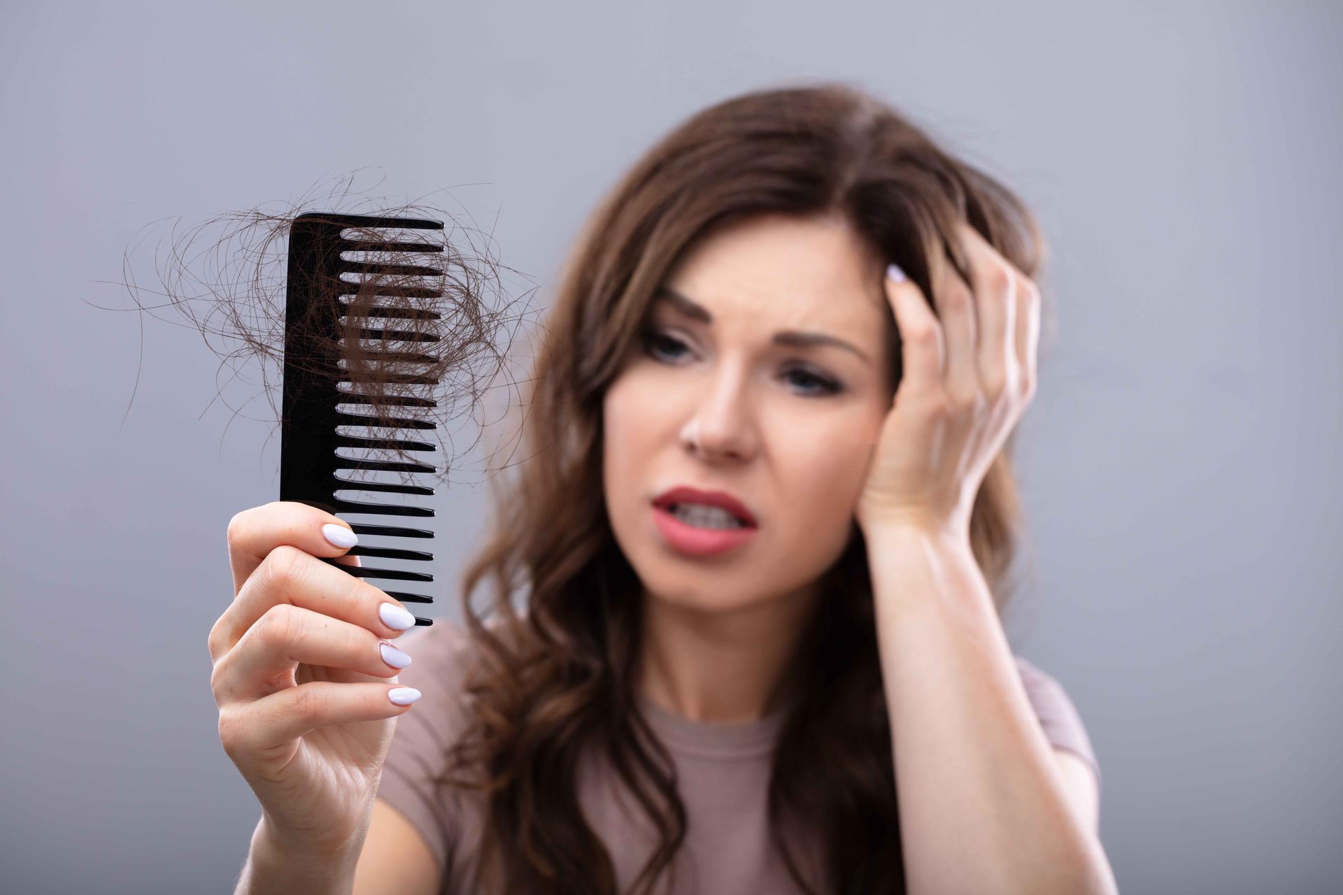 Postpartum Hair Loss: Everything A Mamy Needs to Know