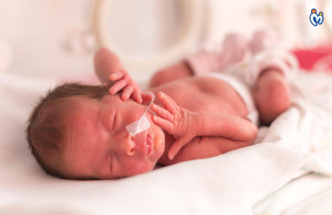 What to know in-case of a premature birth